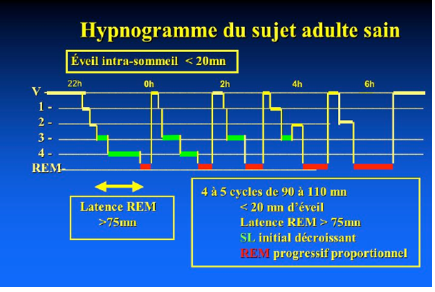 hypnogramme du sujet adulte sain